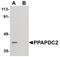 Phospholipid Phosphatase 6 antibody, PA5-20865, Invitrogen Antibodies, Western Blot image 