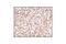 Voltage Dependent Anion Channel 1 antibody, 4866S, Cell Signaling Technology, Immunohistochemistry paraffin image 
