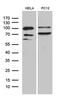Glucose 1,6-bisphosphate synthase antibody, M12656, Boster Biological Technology, Western Blot image 
