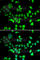 Structural Maintenance Of Chromosomes 1A antibody, A7008, ABclonal Technology, Immunofluorescence image 
