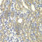 Kelch Repeat And BTB Domain Containing 7 antibody, A7392, ABclonal Technology, Immunohistochemistry paraffin image 