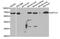 UDP Glucuronosyltransferase Family 1 Member A1 antibody, STJ27947, St John