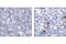 Caspase 3 antibody, 9661T, Cell Signaling Technology, Immunohistochemistry paraffin image 