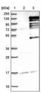 Zinc Finger CCCH-Type Containing 11A antibody, PA5-55890, Invitrogen Antibodies, Western Blot image 