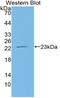 Vascular Endothelial Growth Factor 145  antibody, LS-C375060, Lifespan Biosciences, Western Blot image 