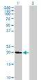 Ubiquitin-fold modifier-conjugating enzyme 1 antibody, H00051506-B01P, Novus Biologicals, Western Blot image 