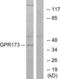 Probable G-protein coupled receptor 173 antibody, LS-C120700, Lifespan Biosciences, Western Blot image 