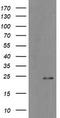 Myosin regulatory light chain 2, atrial isoform antibody, TA800174AM, Origene, Western Blot image 