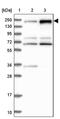 Sister chromatid cohesion protein PDS5 homolog B antibody, PA5-59029, Invitrogen Antibodies, Western Blot image 