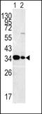 3-mercaptopyruvate sulfurtransferase antibody, PA5-72518, Invitrogen Antibodies, Western Blot image 