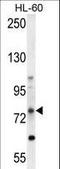 Ald antibody, LS-C155854, Lifespan Biosciences, Western Blot image 
