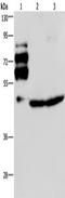 Proprotein Convertase Subtilisin/Kexin Type 9 antibody, TA351505, Origene, Western Blot image 