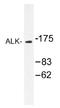 ALK Receptor Tyrosine Kinase antibody, AP01443PU-N, Origene, Western Blot image 