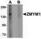 Zinc Finger MYM-Type Containing 1 antibody, NBP1-76523, Novus Biologicals, Western Blot image 