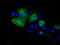26S protease regulatory subunit 6A antibody, TA500933, Origene, Immunofluorescence image 