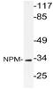 Nucleophosmin 1 antibody, AP21057PU-N, Origene, Western Blot image 