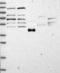 Cytoplasmic tRNA 2-thiolation protein 2 antibody, NBP1-88457, Novus Biologicals, Western Blot image 