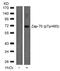 Zeta Chain Of T Cell Receptor Associated Protein Kinase 70 antibody, AP02442PU-N, Origene, Western Blot image 