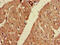 Fatty Acid Desaturase 1 antibody, CSB-PA007959LA01HU, Cusabio, Immunohistochemistry paraffin image 
