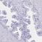 Solute Carrier Family 2 Member 1 antibody, HPA058494, Atlas Antibodies, Immunohistochemistry frozen image 