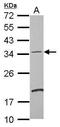 Defective In Cullin Neddylation 1 Domain Containing 4 antibody, PA5-28562, Invitrogen Antibodies, Western Blot image 