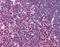 STAT3 antibody, AVARP09057_P050, Aviva Systems Biology, Immunohistochemistry paraffin image 
