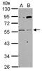 Cholinergic Receptor Nicotinic Gamma Subunit antibody, NBP2-19541, Novus Biologicals, Western Blot image 