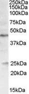 Patatin Like Phospholipase Domain Containing 3 antibody, TA303343, Origene, Western Blot image 