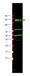 FA Complementation Group A antibody, A03662, Boster Biological Technology, Western Blot image 