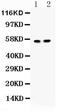 Islet Cell Autoantigen 1 antibody, PA5-79426, Invitrogen Antibodies, Western Blot image 
