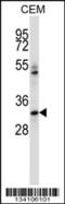 Integrin Binding Sialoprotein antibody, 57-486, ProSci, Western Blot image 