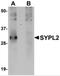 Synaptophysin-like protein 2 antibody, 5255, ProSci, Western Blot image 