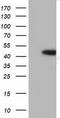 Haptoglobin antibody, TA501675BM, Origene, Western Blot image 