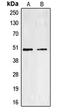 Endothelin Receptor Type A antibody, LS-C352143, Lifespan Biosciences, Western Blot image 