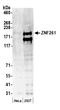 Zinc Finger MYM-Type Containing 3 antibody, A300-264A, Bethyl Labs, Western Blot image 
