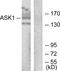 Mitogen-Activated Protein Kinase Kinase Kinase 5 antibody, LS-C118048, Lifespan Biosciences, Western Blot image 