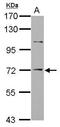 Suppression Of Tumorigenicity 14 antibody, GTX113557, GeneTex, Western Blot image 