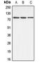 ATP Binding Cassette Subfamily B Member 10 antibody, GTX54895, GeneTex, Western Blot image 