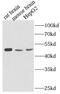 ATP Synthase F1 Subunit Alpha antibody, FNab00703, FineTest, Western Blot image 