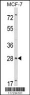 RAS Like Family 11 Member B antibody, 63-646, ProSci, Western Blot image 