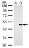 Protein Wnt-8a antibody, GTX128108, GeneTex, Western Blot image 