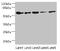 Neuronal acetylcholine receptor subunit alpha-6 antibody, LS-C675531, Lifespan Biosciences, Western Blot image 