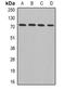 ADAM Metallopeptidase Domain 33 antibody, abx225011, Abbexa, Western Blot image 