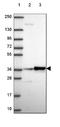 60S ribosomal protein L6 antibody, NBP2-49552, Novus Biologicals, Western Blot image 