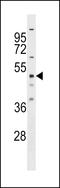RNA Binding Motif Protein 23 antibody, LS-C158823, Lifespan Biosciences, Western Blot image 