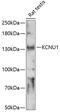 Potassium Calcium-Activated Channel Subfamily U Member 1 antibody, 15-809, ProSci, Western Blot image 