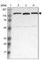 Serine/threonine-protein kinase Nek9 antibody, NBP1-88007, Novus Biologicals, Western Blot image 