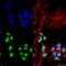 Choline acetyltransferase antibody, SPC-706D-FITC, StressMarq, Immunocytochemistry image 