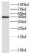 Replication Termination Factor 2 antibody, FNab01087, FineTest, Western Blot image 