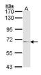 Matrix metalloproteinase-17 antibody, GTX105268, GeneTex, Western Blot image 